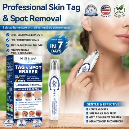𝐇𝐈𝐒𝐊𝐈𝐍®👩‍⚕️ 7-Day Wart & Skin Tag Remover Rollerball Pen ✨ Maximum Strength Precision Care for Common Warts, Plantar Warts & Skin Imperfections | Easy At-Home Treatment