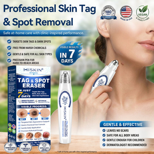 𝐇𝐈𝐒𝐊𝐈𝐍®👩‍⚕️ 7-Day Wart & Skin Tag Remover Rollerball Pen ✨ Maximum Strength Precision Care for Common Warts, Plantar Warts & Skin Imperfections | Easy At-Home Treatment